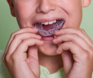 เฝือกสบฟันหรือฟันยาง